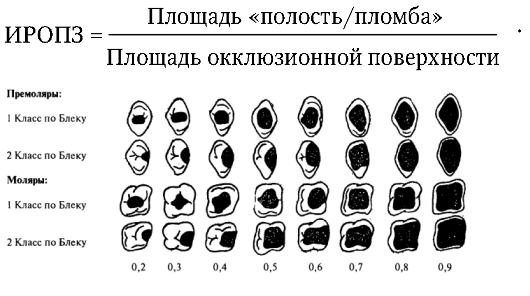 ИРОПЗ