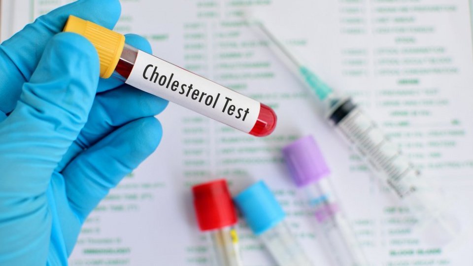 Норма холестерина в крови: каким должен быть анализ