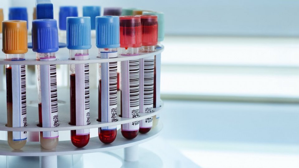 Основные виды анализов крови