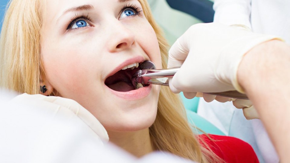 Осложнения после удаления зубов: кровотечение