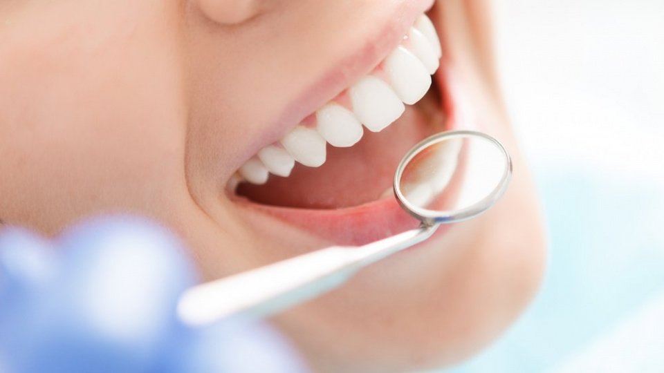 На какие болезни указывает черный налет на зубах?