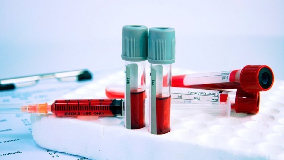 Анализ крови: лейкоциты, эритроциты, СОЭ и гемоглобин