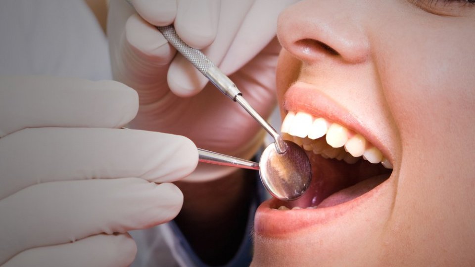 Платные пломбы или как стоматологи разводят на деньги