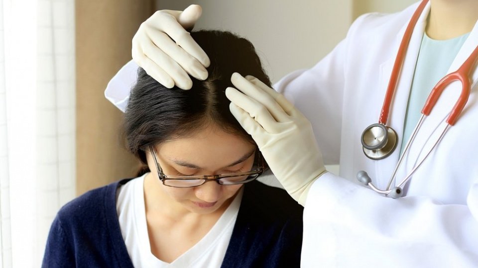 Псориаз на волосистой части головы: как его лечить?