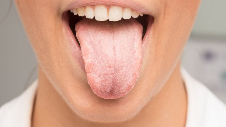 Воспаление языка – глоссит: причины, симптомы